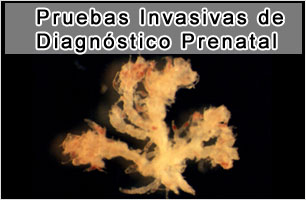 Pruebas Invasivas de Diagnóstico Prenatal