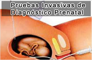 Pruebas Invasivas de Diagnóstico Prenatal