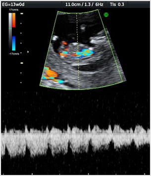 Ecografía Obstétrica