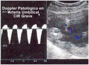 Ecografía Obstétrica