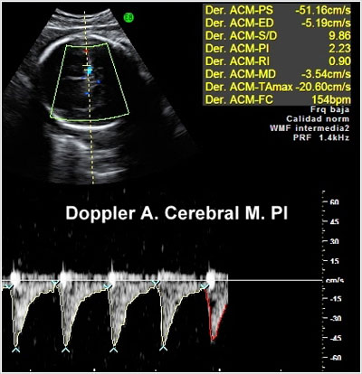 Ecografía Obstétrica