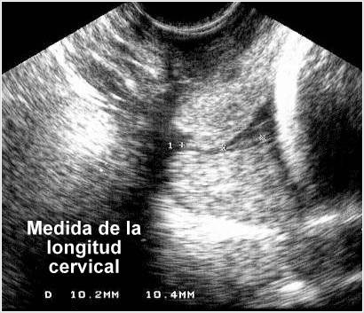 Ecografía Obstétrica