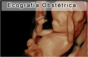 Ecografía Obstétrica